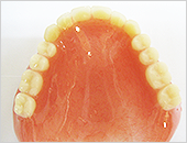 レジン床義歯（保険適用）